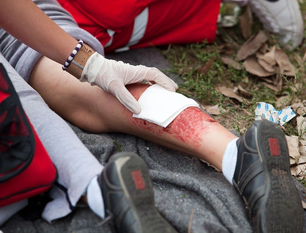 Motor Vehicle Injuries